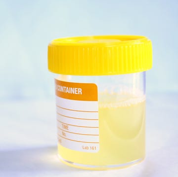 urine sample