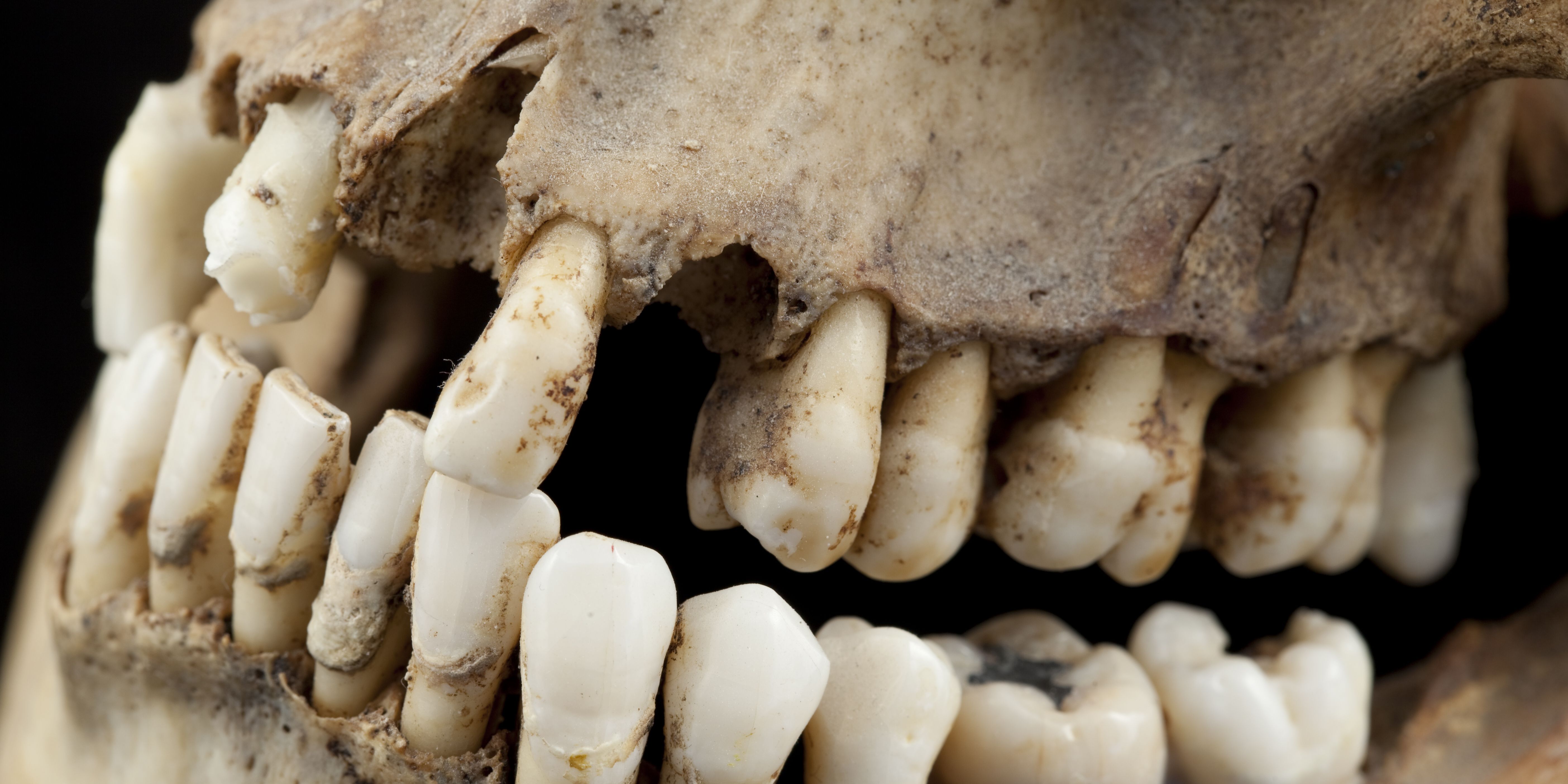 very-bad-teeth-indeed-royalty-free-image-1746647713.pjpeg