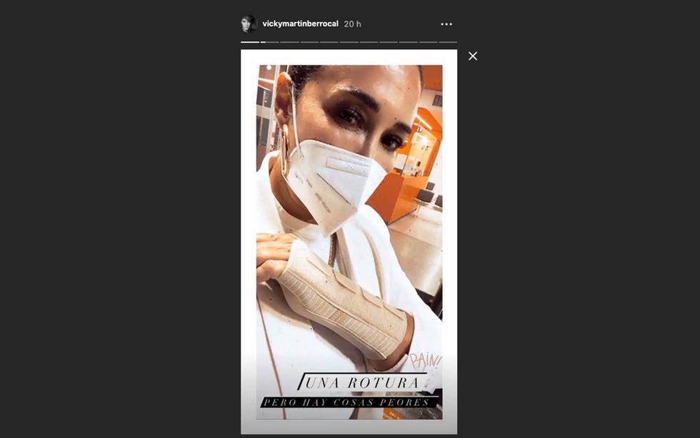 vicky martín berrocal cuenta en instagram cómo se ha roto la muñeca