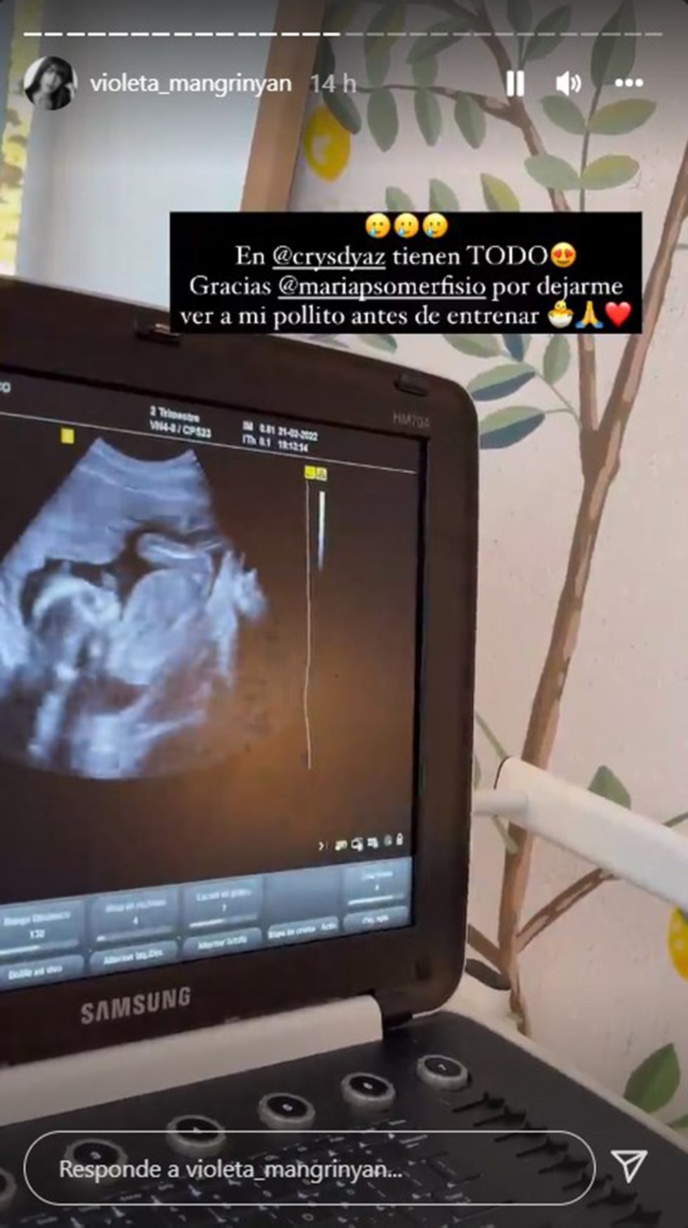violeta mangriñán muestra una de sus ecografías
