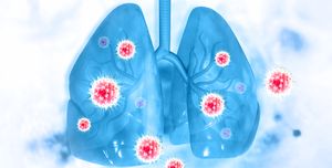 virus and bacteria infected the human lungs lung disease