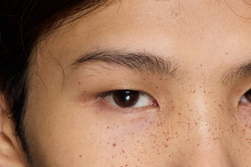 best eye creams for dark circles