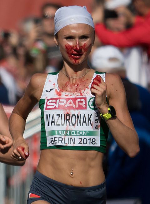 Volha Mazuronak Bloody Nose European Championships