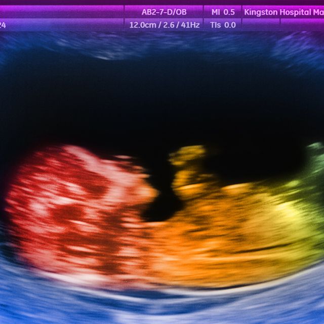 12 week old baby scan in rainbow colors