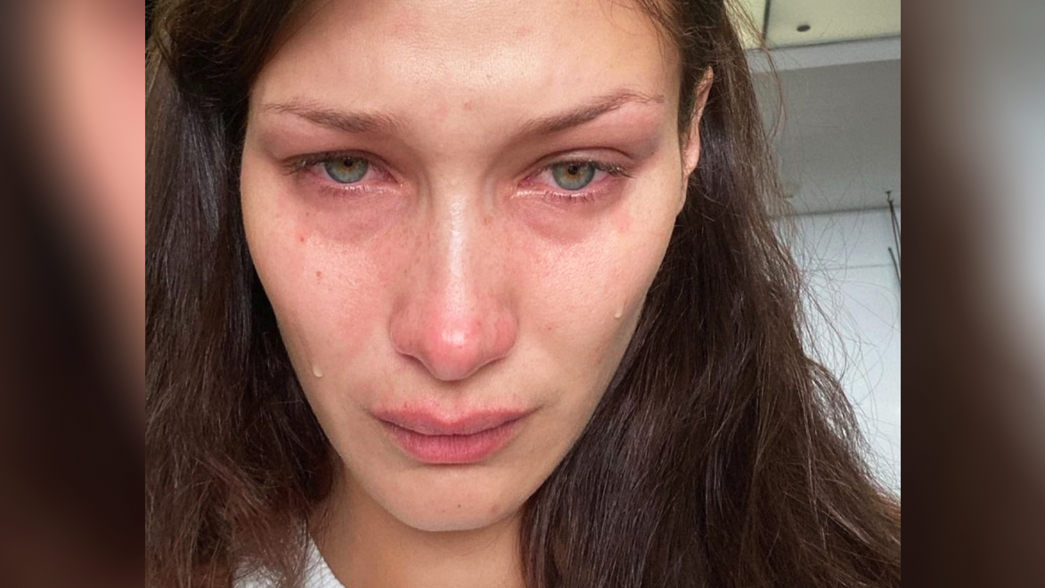 Bella Hadid opens up about mental health in the fashion industry