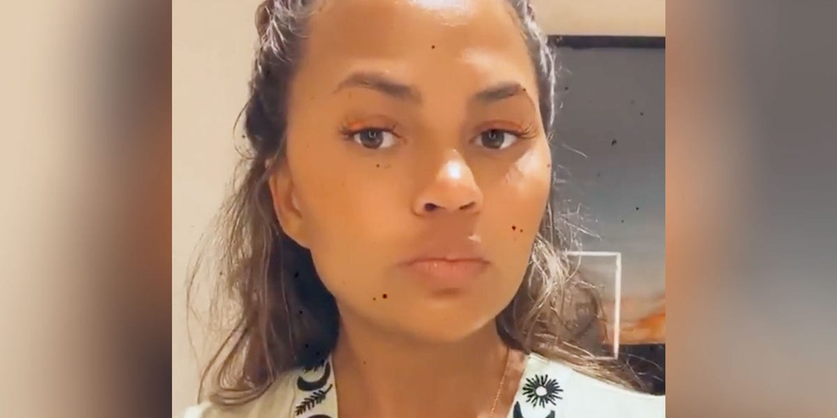 Chrissy Teigen Shares Her Full Skincare Routine In Instagram Video