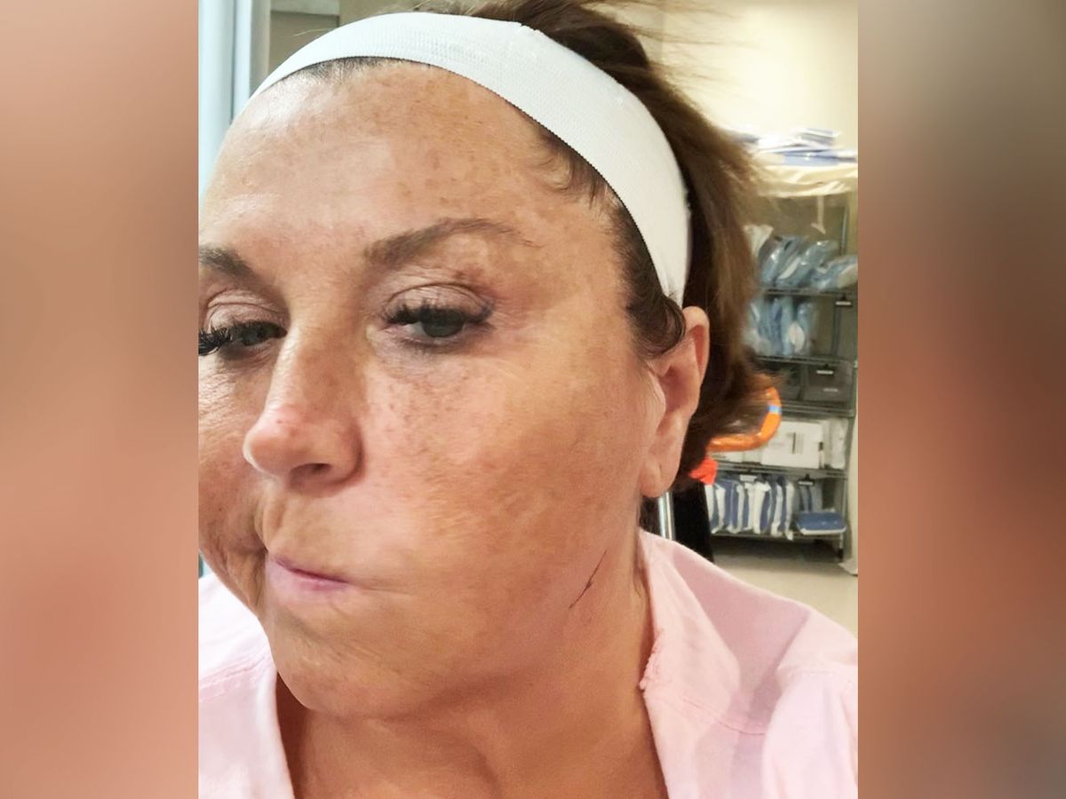 Abby Lee Miller Shows Freckles In Rare No-Makeup Instagram Selfies