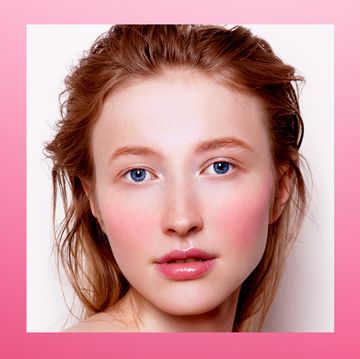 face with rosacea