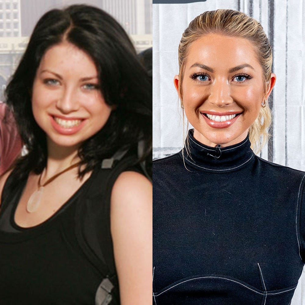 Stassi Schroeder Talks Chin Implant Plastic Surgery In New Book