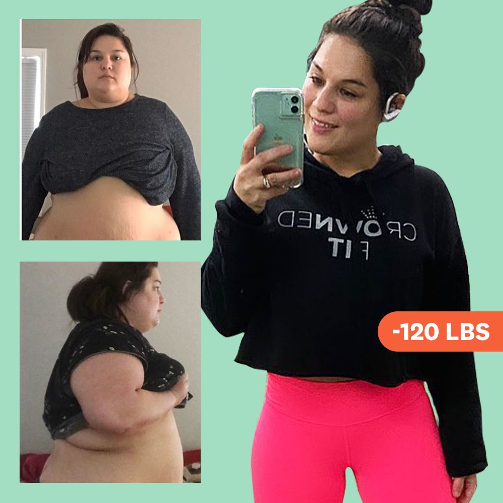 Weight Loss Surgery To A Competition