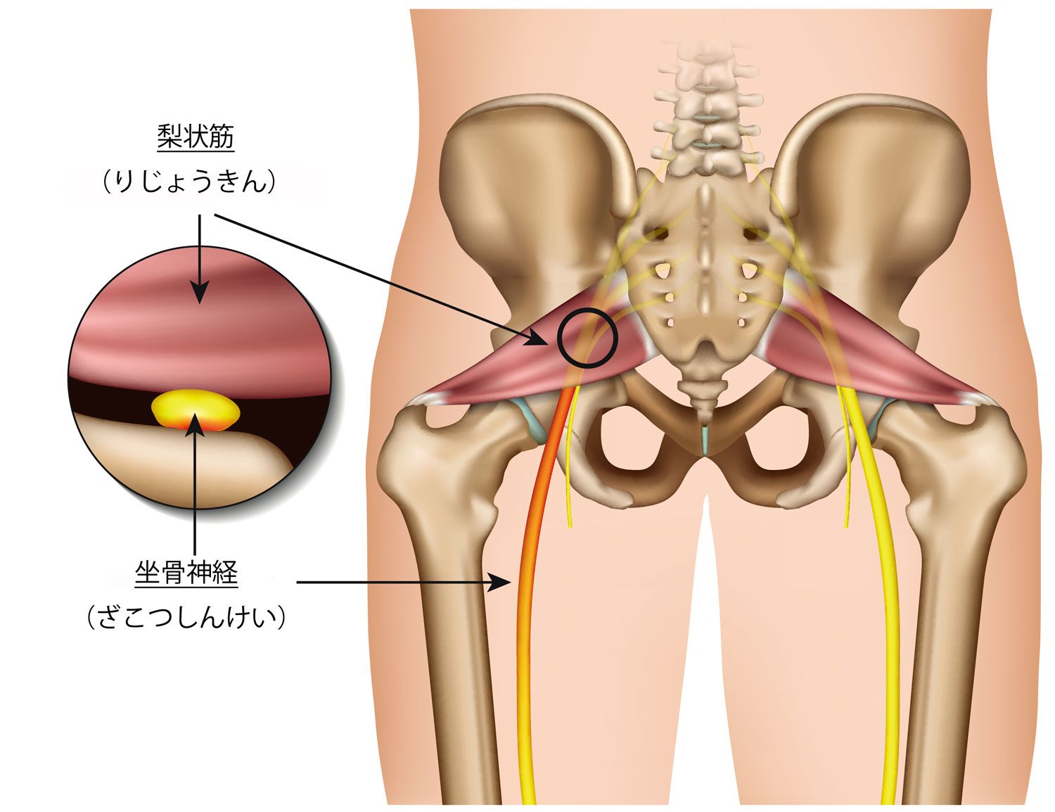 理学療法士が監修｜「坐骨神経痛」緩和を寝ながら目指す効果的な