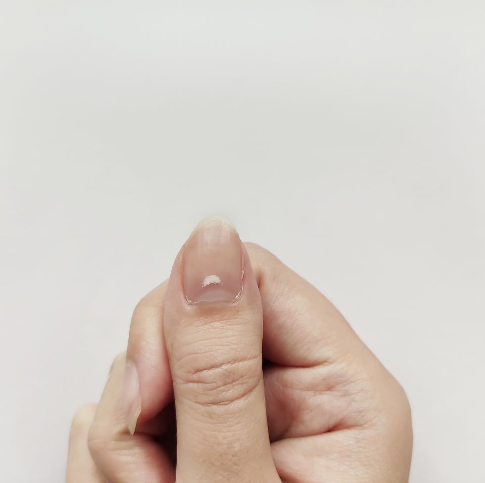 戒掉傷指甲的5個壞習慣！甲床保養好手指看起來更修長 甲面看出健康狀況
