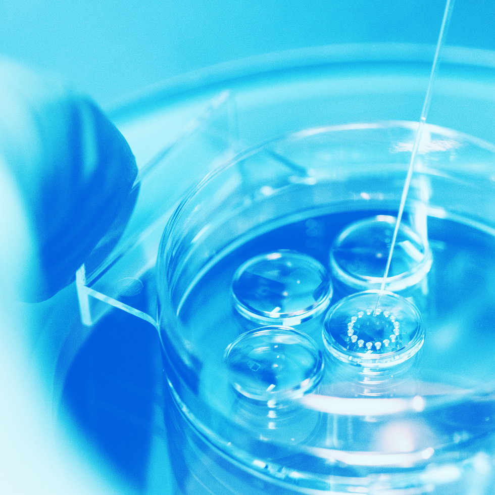closeup process of laboratory fertilization with material in petri dish and needle in modern reproductive medicine clinic