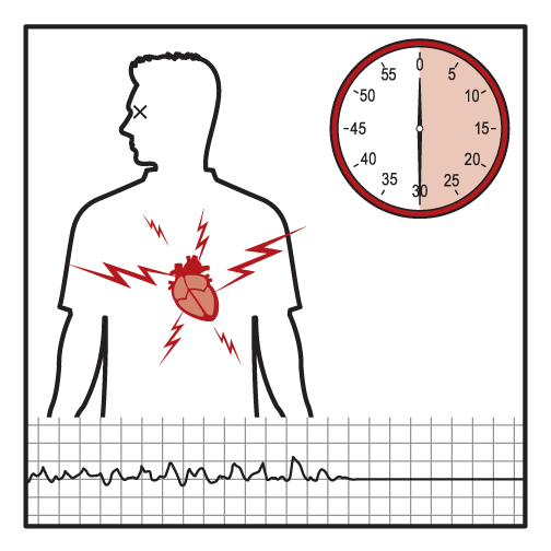 Adventist Health on X: What makes a widow-maker heart attack so dangerous?  Visit  to learn all about the widow-maker heart  attack, ways to reduce your risk and signs to look for