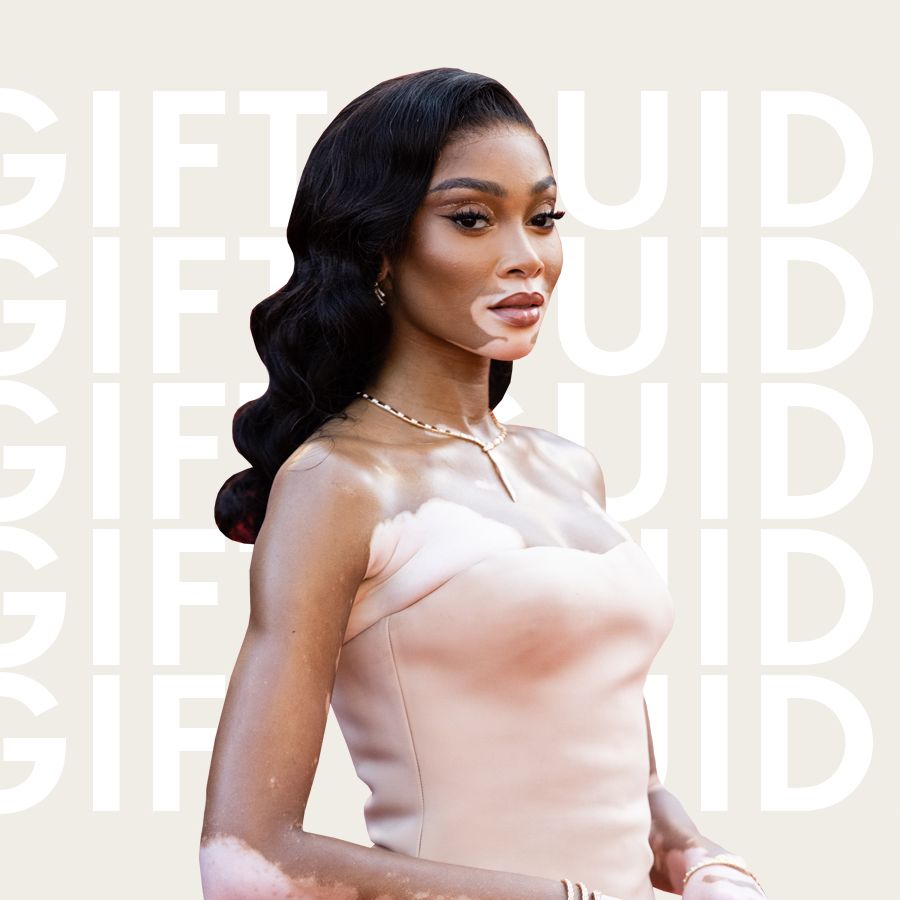 From 'cow' to cover girl, model Winnie Harlow is changing beauty standards