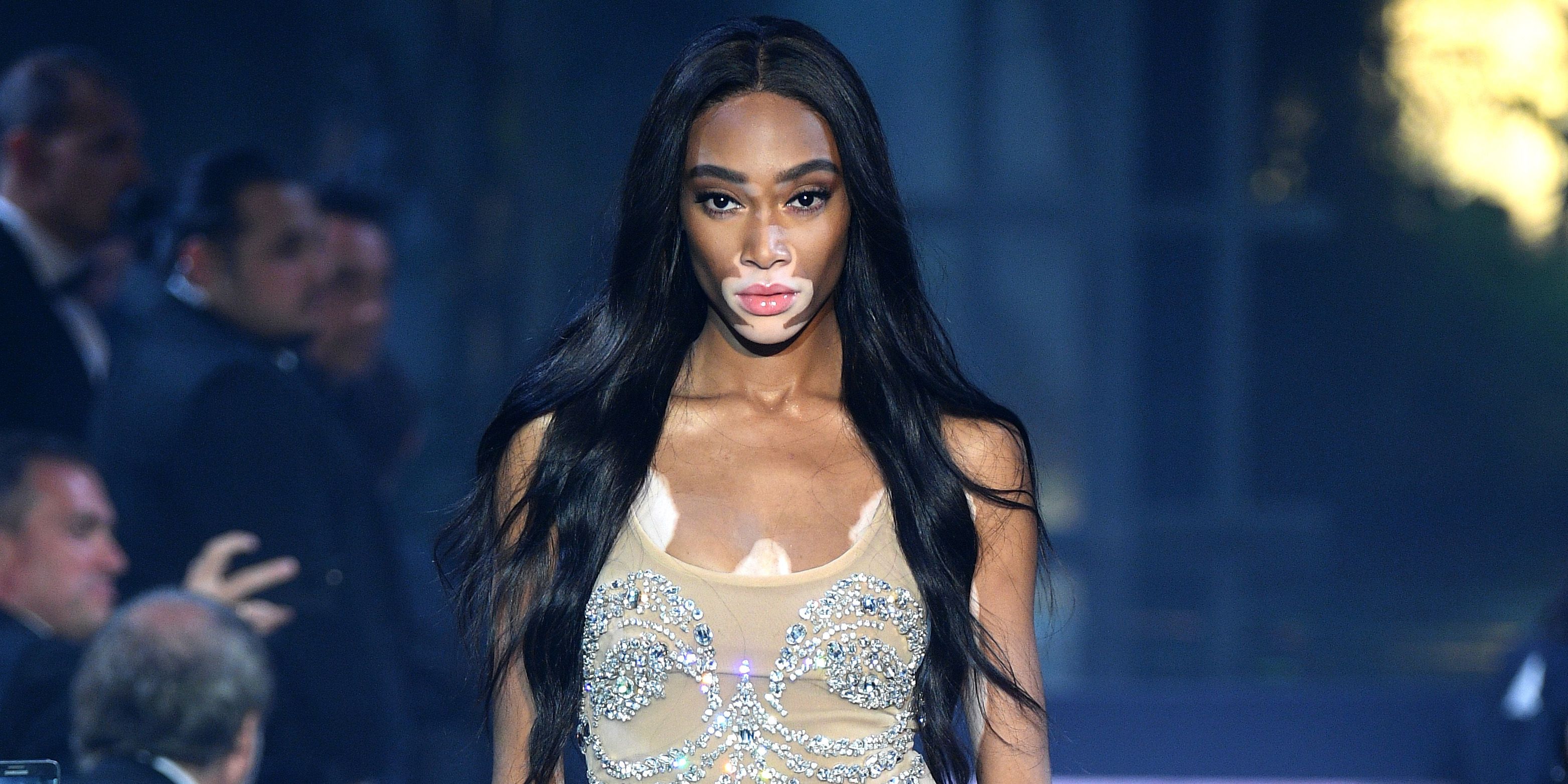 https://hips.hearstapps.com/hmg-prod/images/winnie-harlow-1536431248.jpg