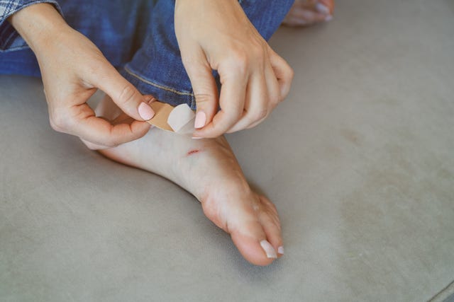 como arreglar las ampollas en los pies