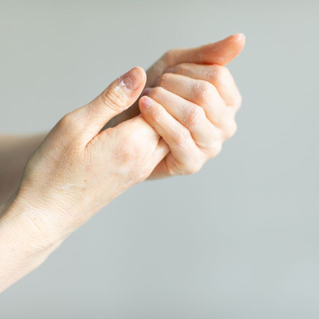 woman applying hand cream to relieve the dry skin caused by hand sanitizer