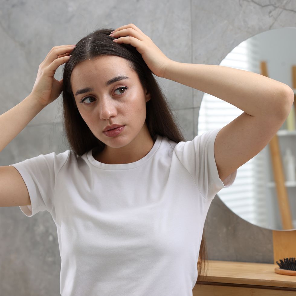 woman examining her hair and scalp at home dandruff problem