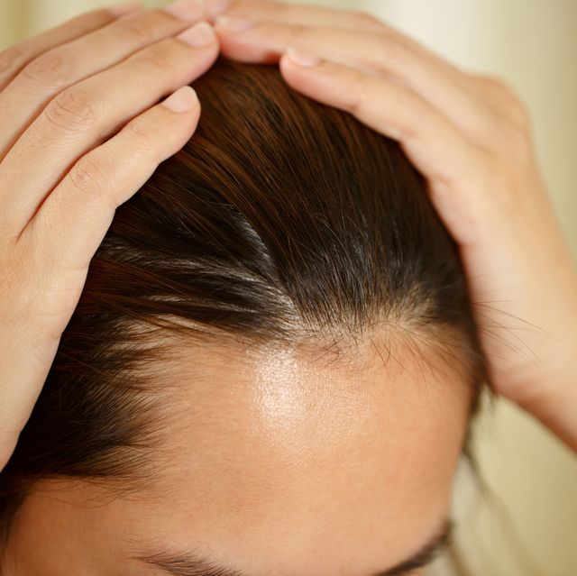 a woman has problems with hair and scalp
