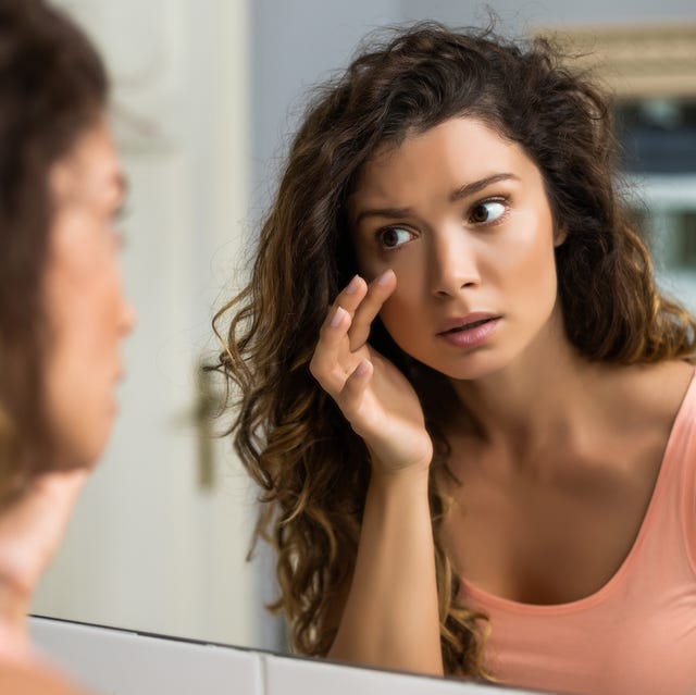 woman looking eye bags