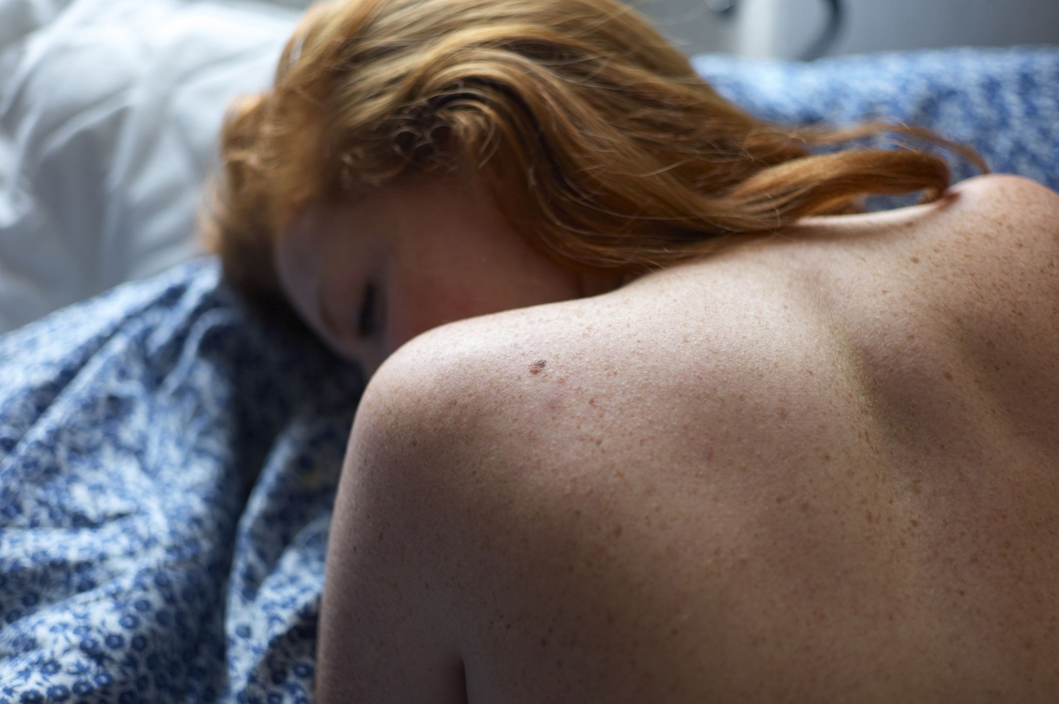woman on bed showing her naked shoulders with freckles