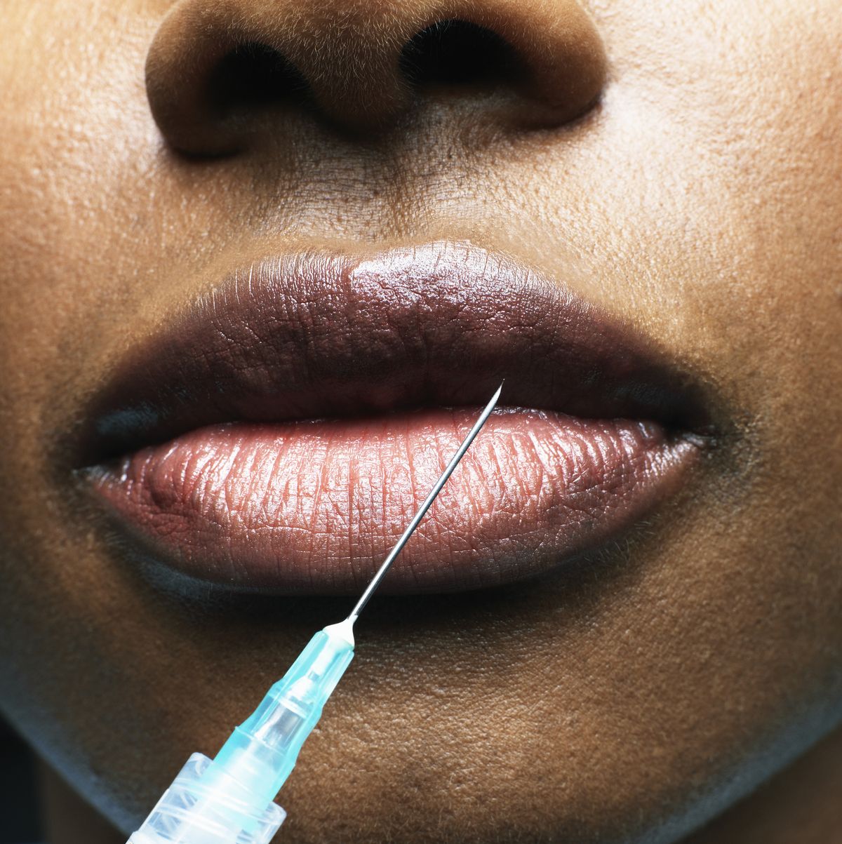 Lip filler: Why over-inflated lips are finally out