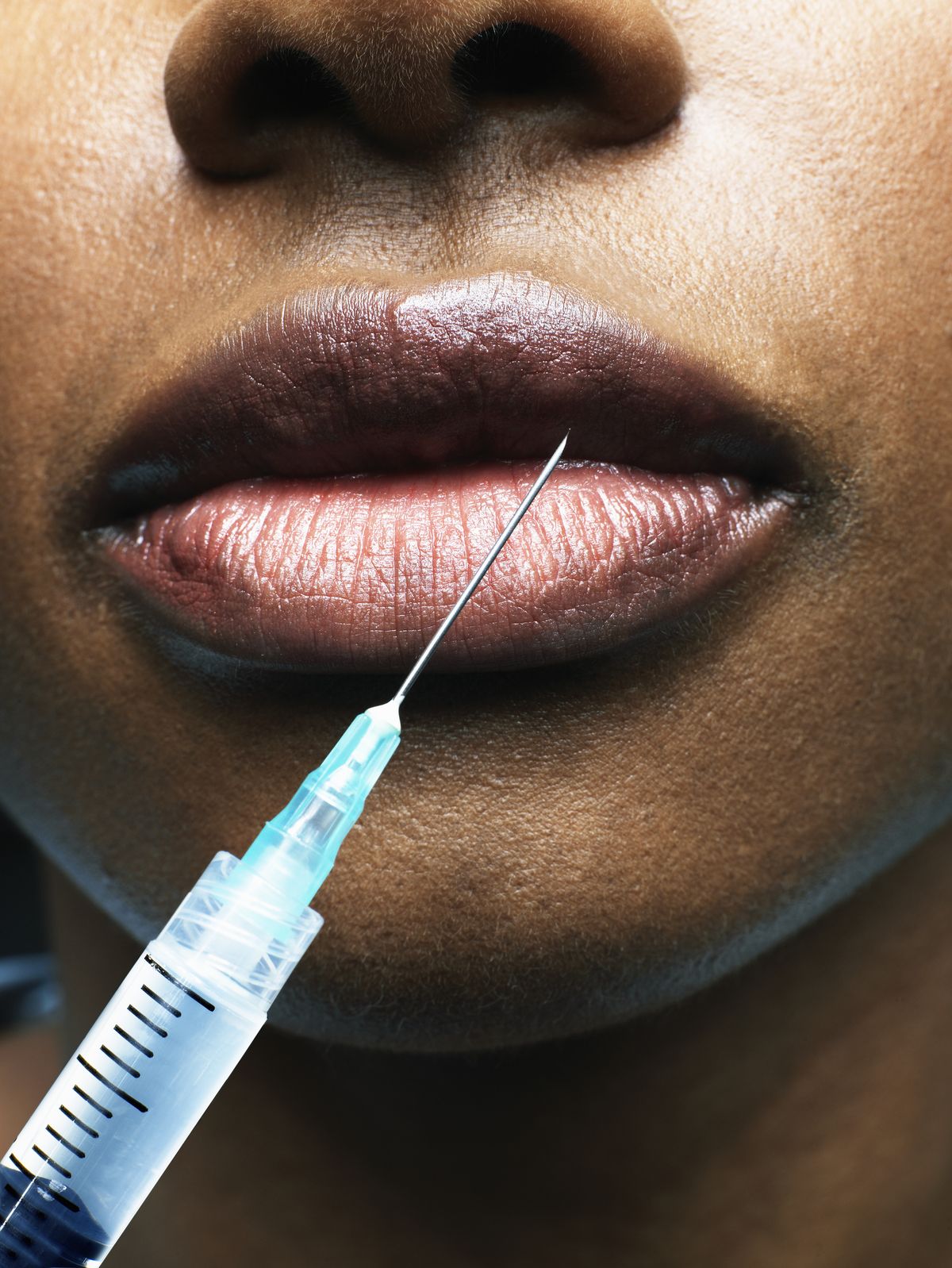 woman receiving injection in lip, close up