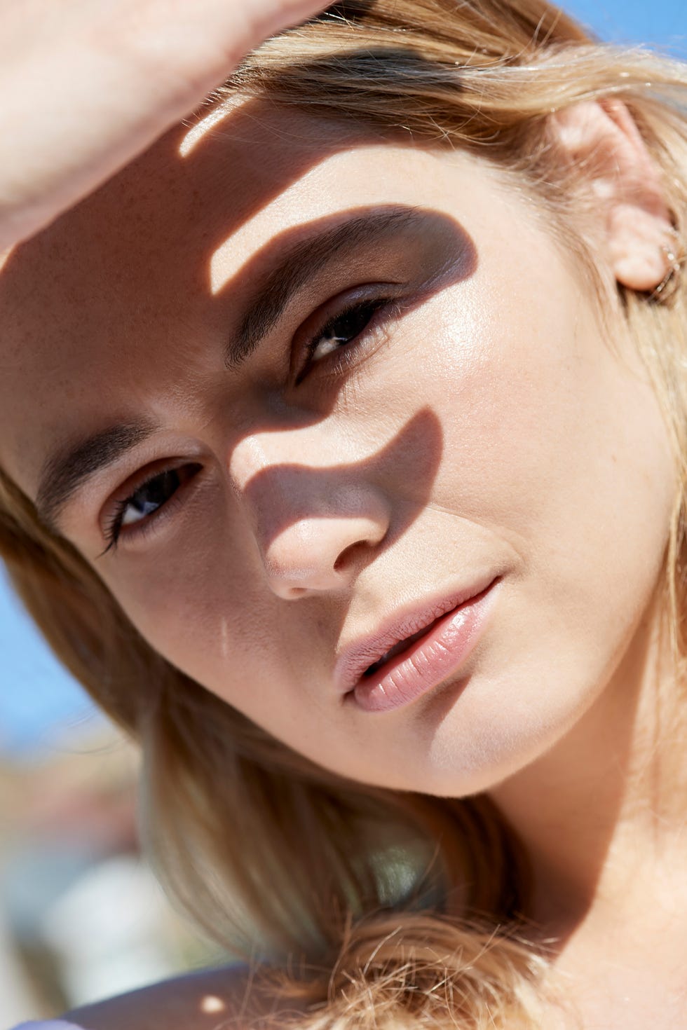 How to treat sunburn 