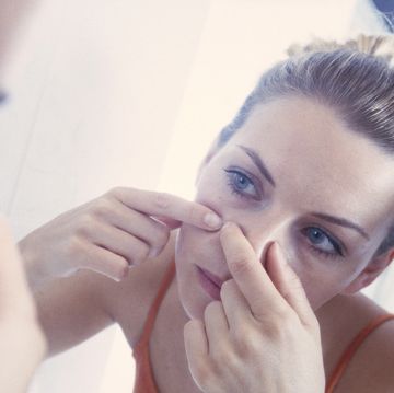 Woman squeezing pimple
