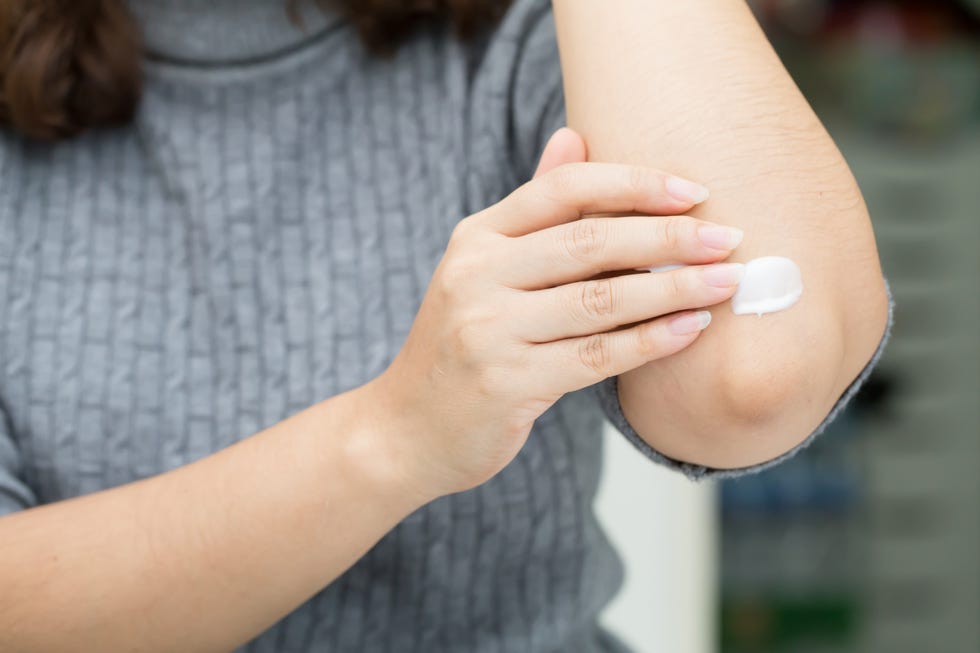Woman takes care of elbow using cosmetic cream