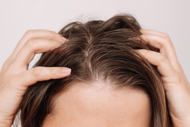 woman fingers touching scalp
