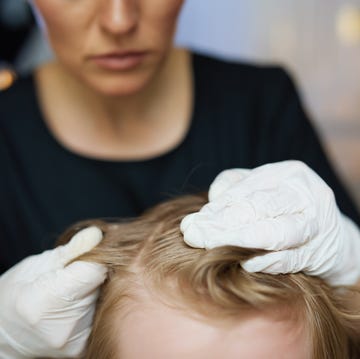 Woman trichologist in rubber gloves checking child hair woman trichologist in rubber gloves checking child hair