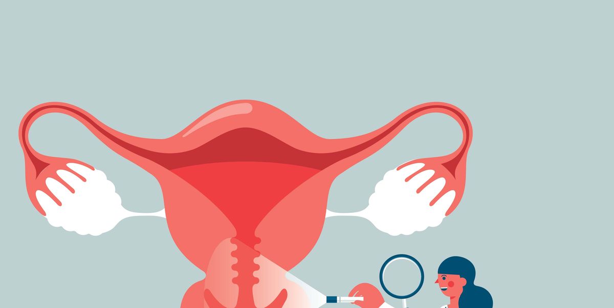 10 Subtle Signs of Cervical Cancer, According to Doctors
