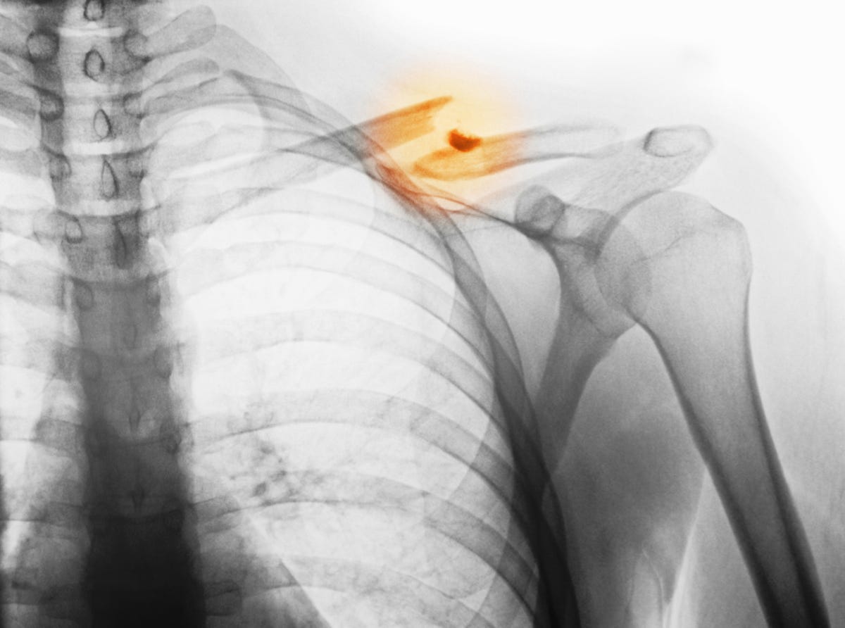 A 2-Million-Year-Old Human Clavicle Just Took an Epic Trip to Space