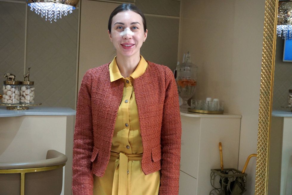 yana mudrakova an employee at anacsoma clinic who recently had rhinoplasty
