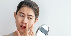 young asian woman worry about her face when she saw the problem of acne and scar by the mini mirror