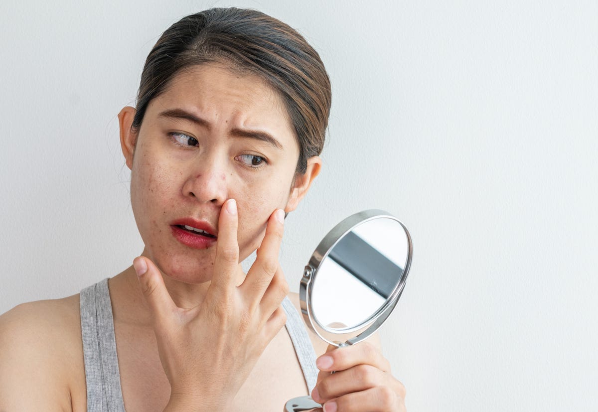 Blind Pimple: What It Is and How to Get Rid of the Type of Acne