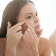 young female unsatisfied with state of her skin, squeezing pimple in front of mirror, trying to cope with facial problems before important meeting or date