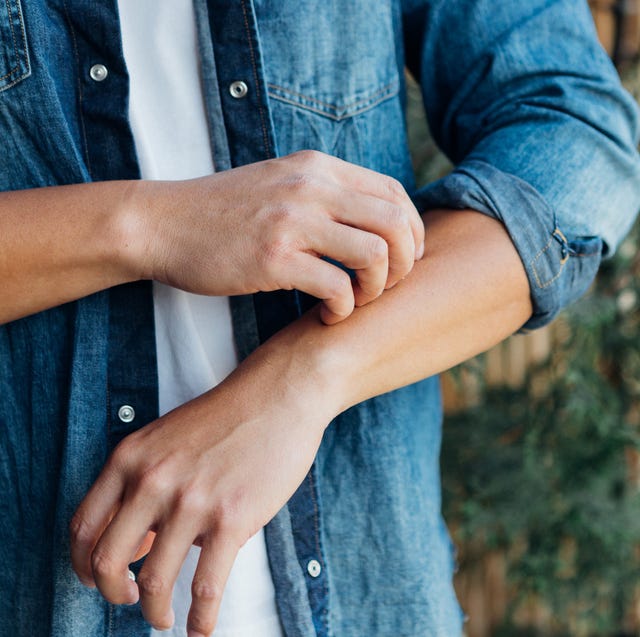 young man scratching forearm with fingers