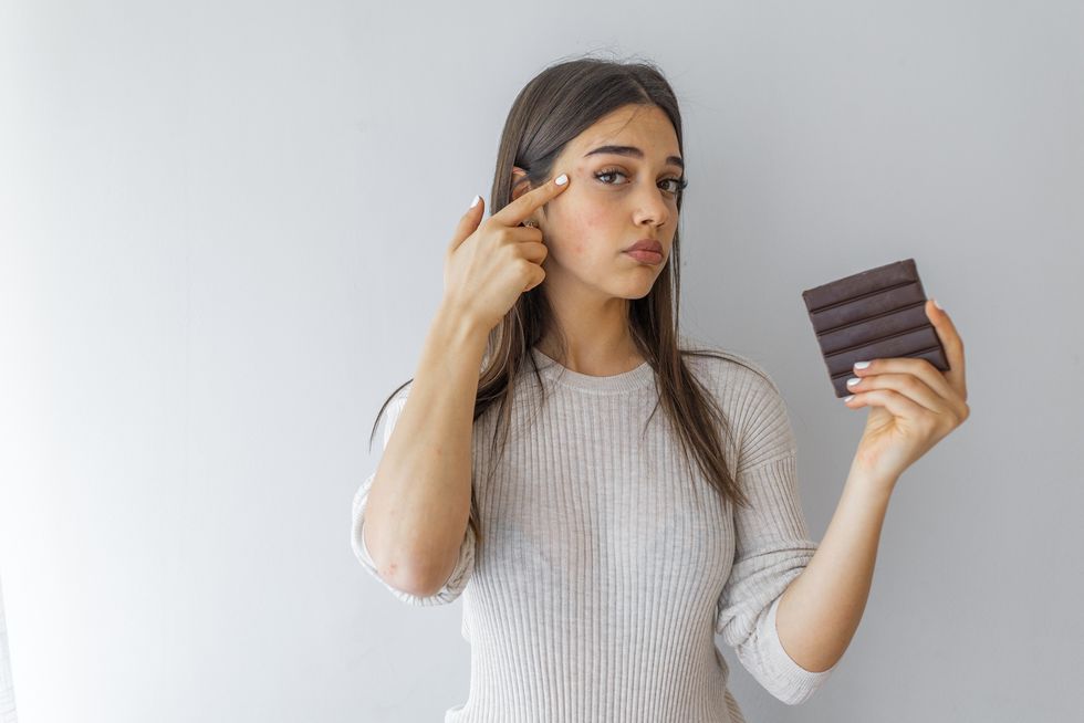 young woman acne problem face with chocolate bar