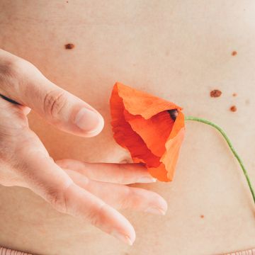 young woman belly with red flower naked abdomen with many birthmarks