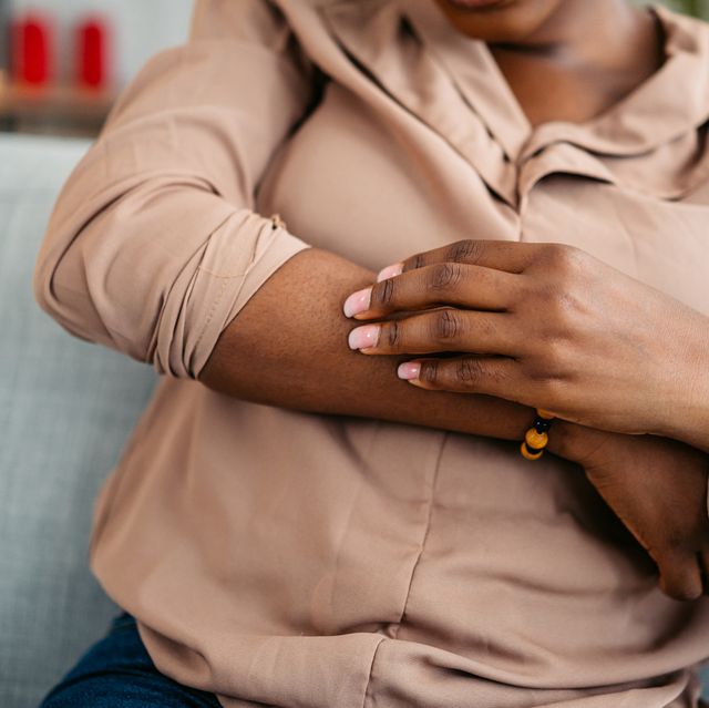 young woman scratching her skin at home