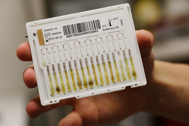 Alexander&#x20;Zitoli,&#x20;Steep&#x20;Hill&#x20;senior&#x20;lab&#x20;technician,&#x20;holds&#x20;a&#x20;cannabis&#x20;flower&#x20;sample&#x20;in&#x20;tweezers&#x20;while&#x20;placing&#x20;it&#x20;into&#x20;a&#x20;container&#x20;to&#x20;be&#x20;weighed&#x20;as&#x20;he&#x20;demonstrates&#x20;part&#x20;of&#x20;the&#x20;process&#x20;of&#x20;working&#x20;with&#x20;cannabis&#x20;samples&#x20;in&#x20;the&#x20;chemical&#x20;testing&#x2F;safety&#x20;lab&#x20;at&#x20;Steep&#x20;Hill&#x20;Labs&#x20;&#x20;on&#x20;Monday,&#x20;June&#x20;26,&#x20;2017&#x20;in&#x20;Berkeley,&#x20;Calif.