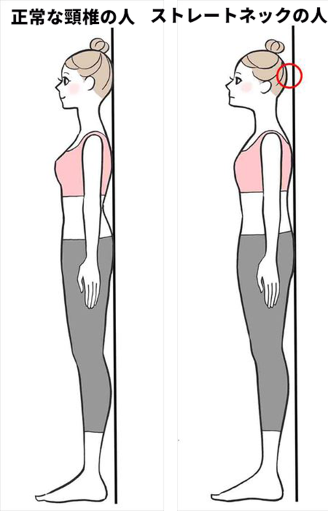 あなたは大丈夫 ストレートネックからくる不調とその改善法