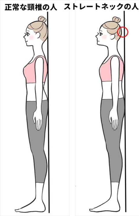 あなたは大丈夫 ストレートネックからくる不調とその改善法 あなたは大丈夫 ストレートネックからくる不調とその改善法