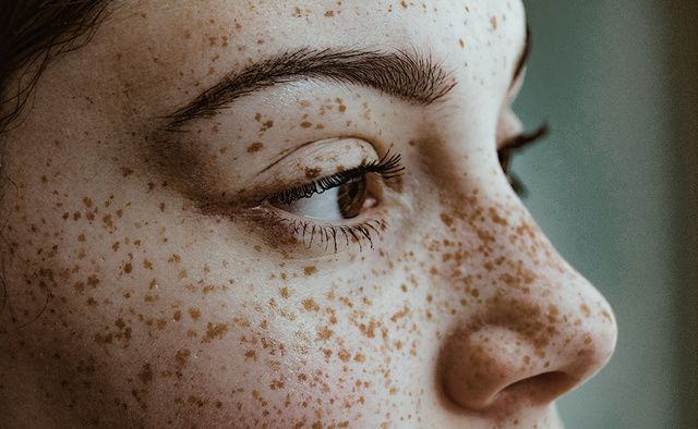 Face, Nose, Skin, Freckle, Close-up, Eyebrow, Head, Eye, Eyelash, Cheek, 