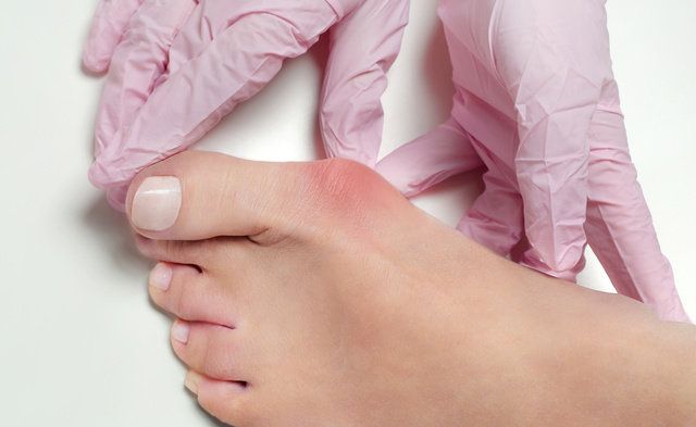 Pink, Skin, Nail, Leg, Finger, Hand, Foot, Toe, Joint, Close-up, 