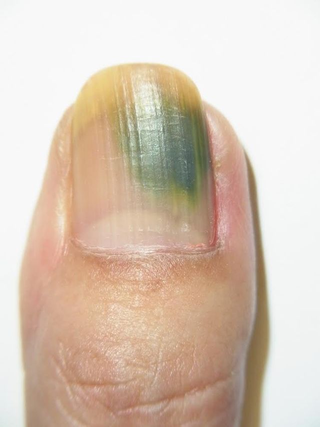 Nail, Green, Finger, Skin, Nail polish, Hand, Close-up, Material property, Nail care, Thumb, 