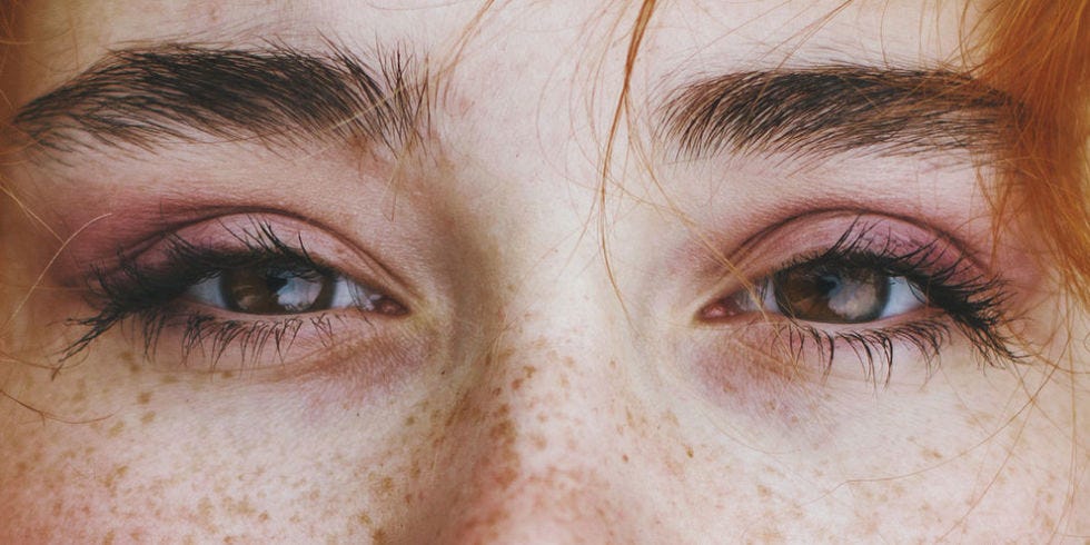 Facts About Freckles - Weird Things About Freckles